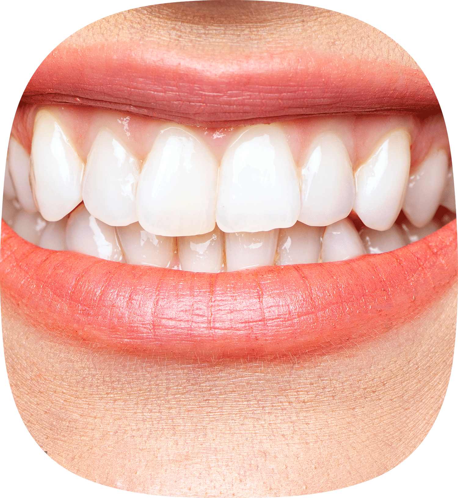 centro-odontoiatrico-signorelli-igiene-orale-atf